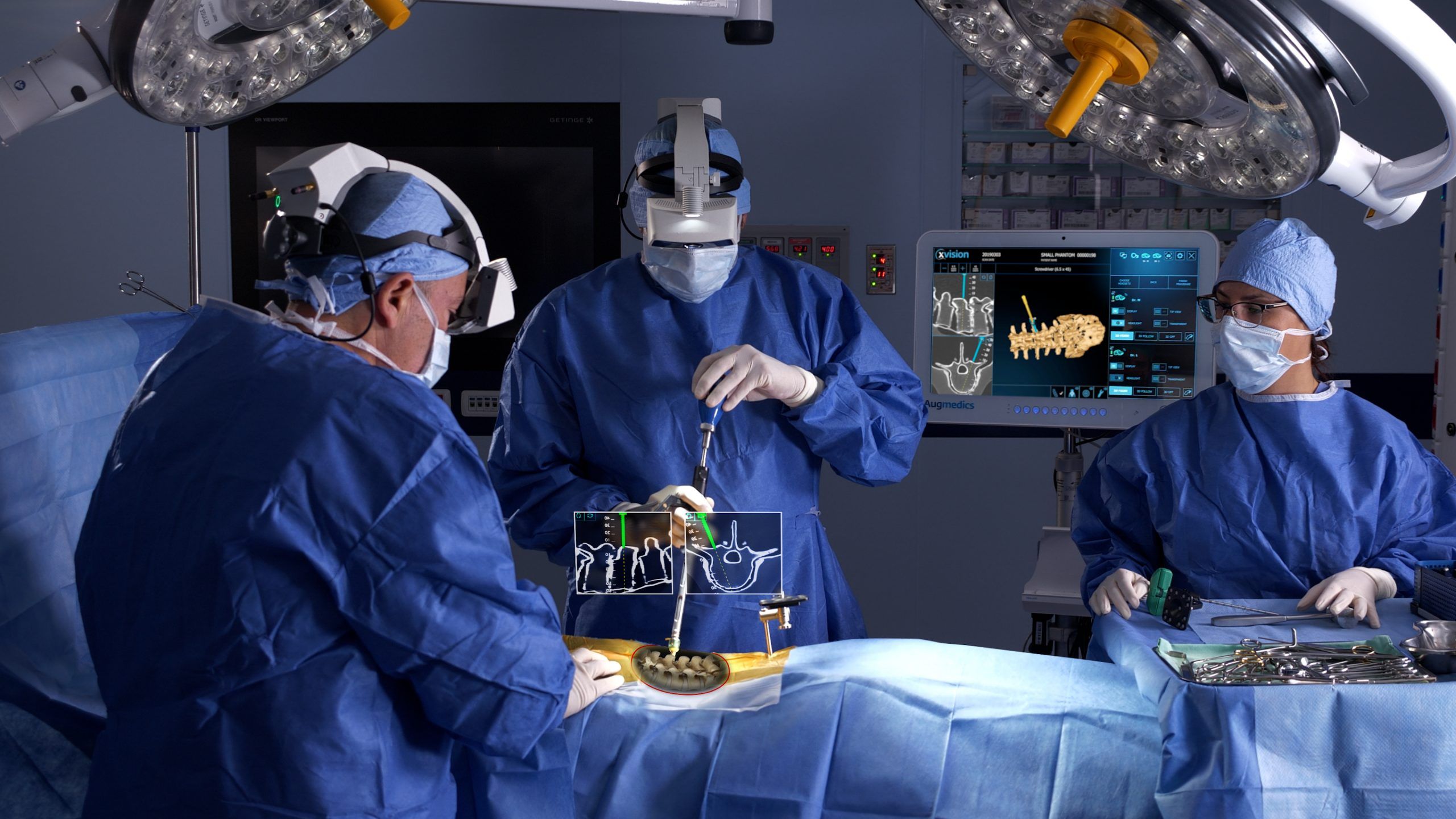 A photo that shows the UConn Health's AR-guided spine surgery. There are three surgeons in an operating theatre operating on a patient. Information and visuals on the spine is being overlayed over the real-world environment.